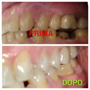 Confronto pre e post intervento